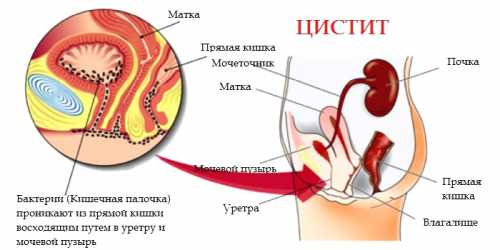 цистит у собаки: симптомы, лечение в домашних условиях, профилактика