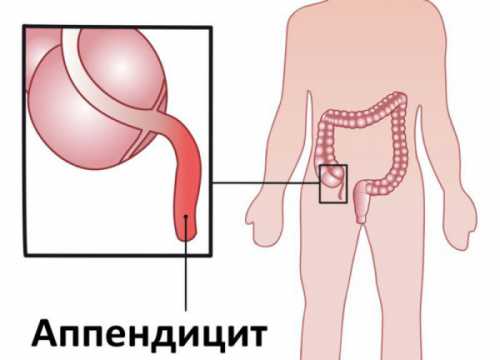 разрешены ли суши во время беременности